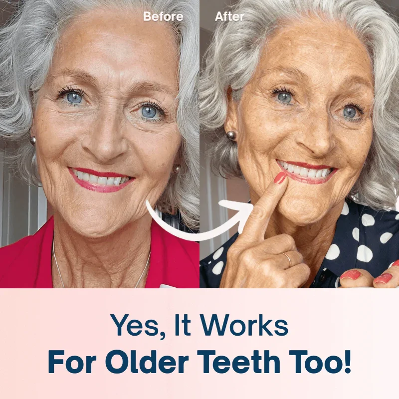 Strawberry Teeth Whitening Powder - Image 4