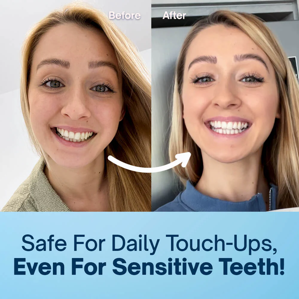 Precision Teeth Whitening Pen - Image 7