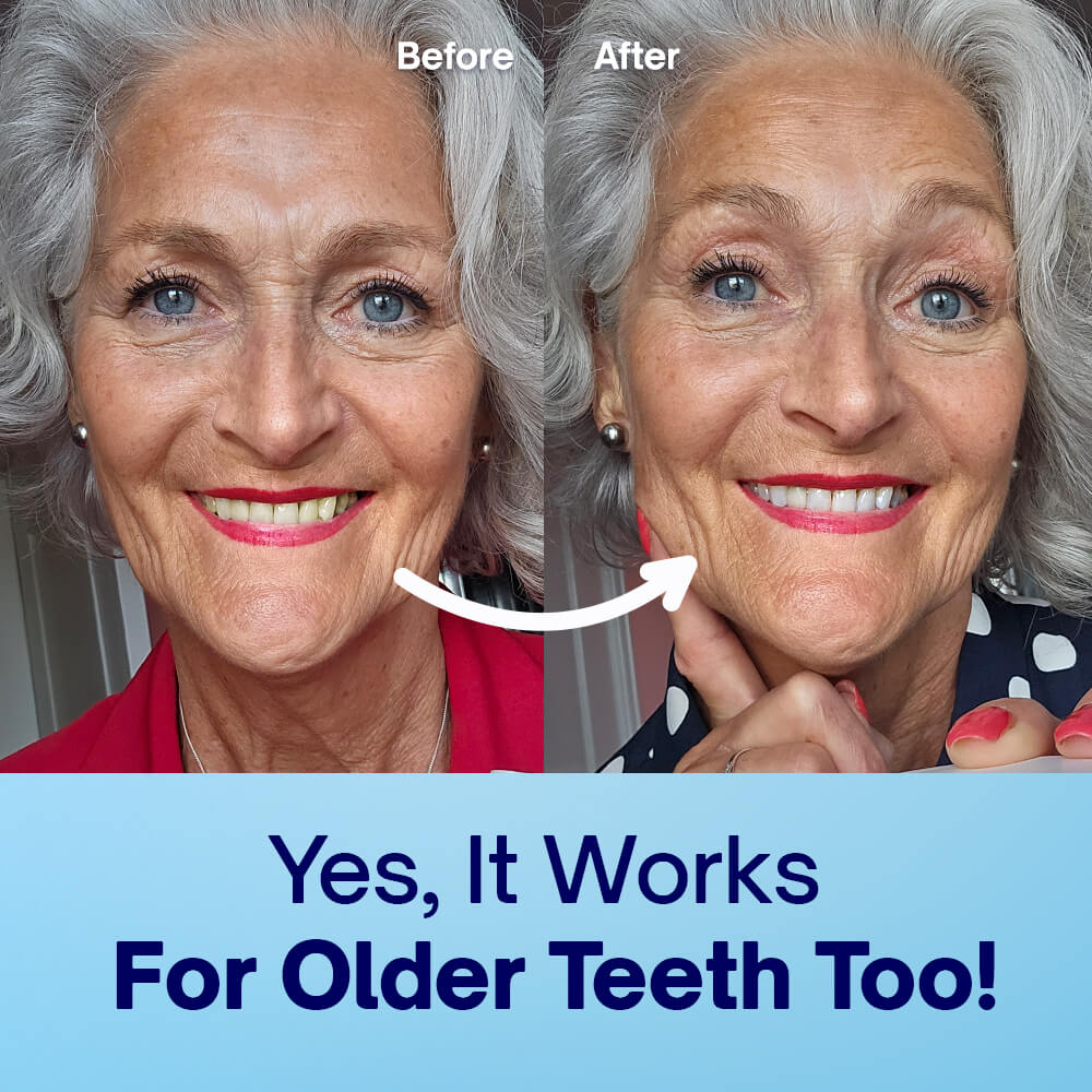 Dentist-Approved Teeth Whitening Powder - Image 7
