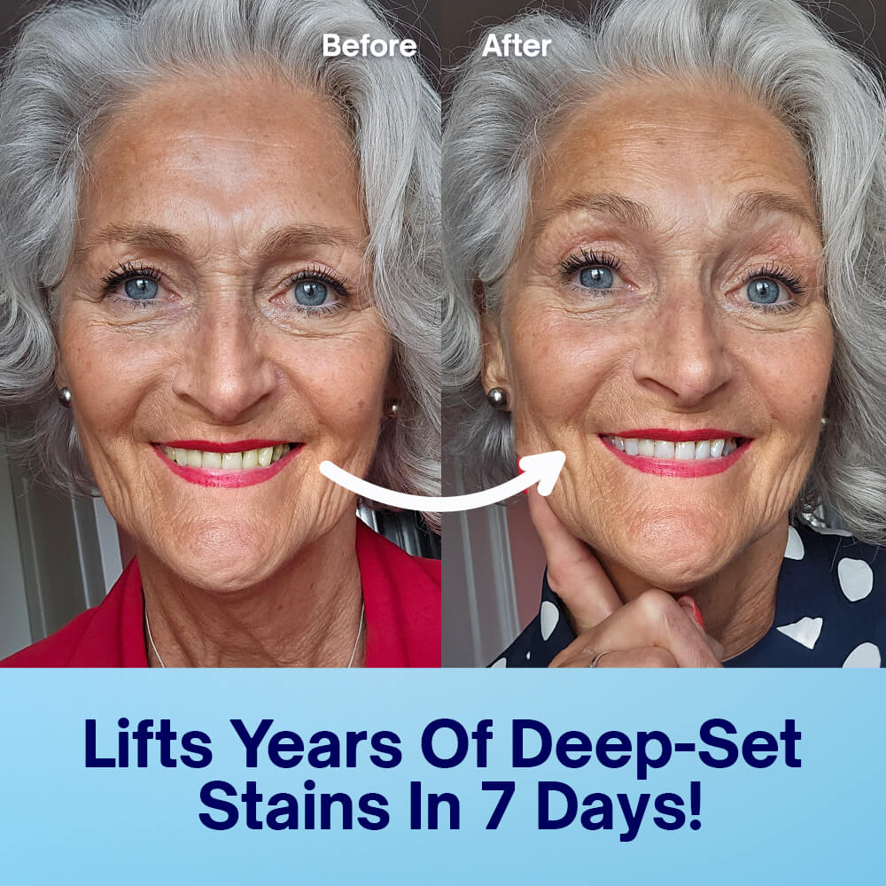 PAP Teeth Whitening Strips - Image 7